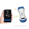 Color Doppler Wireless Sondenscanner